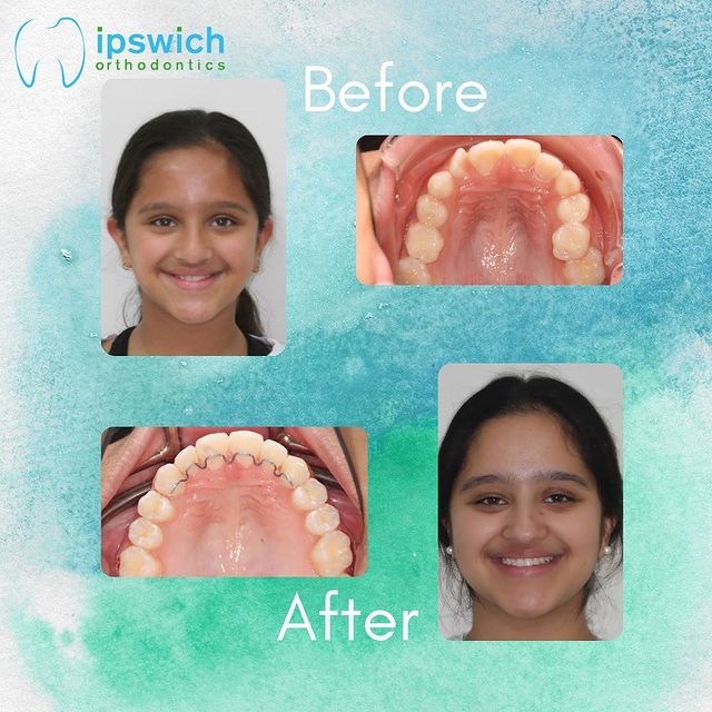 Get social with Ipswich Orthodontics Get social with Ipswich Orthodontics