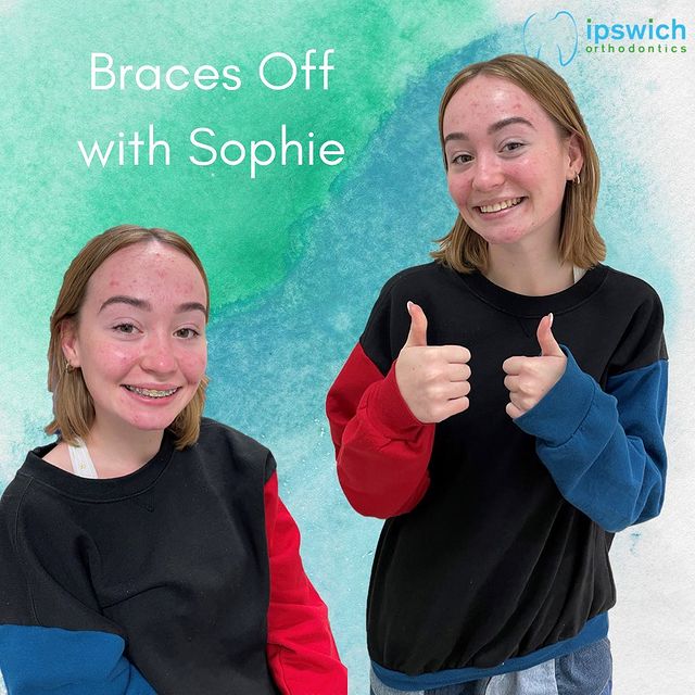 Get social with Ipswich Orthodontics Get social with Ipswich Orthodontics