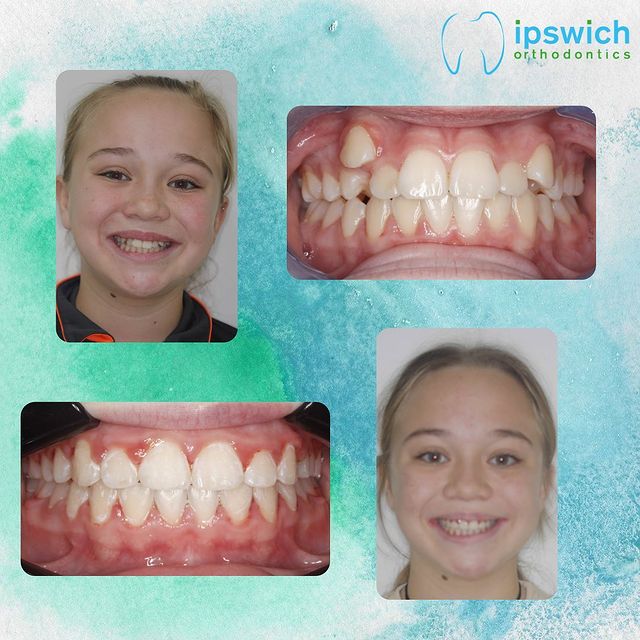 Get social with Ipswich Orthodontics Get social with Ipswich Orthodontics
